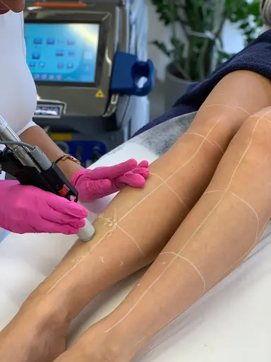 DepiLab - Depilacja laserowa